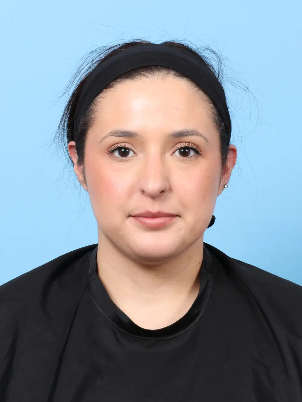 Rhinoplasty Patient Photo - Case 57913 - after view-2