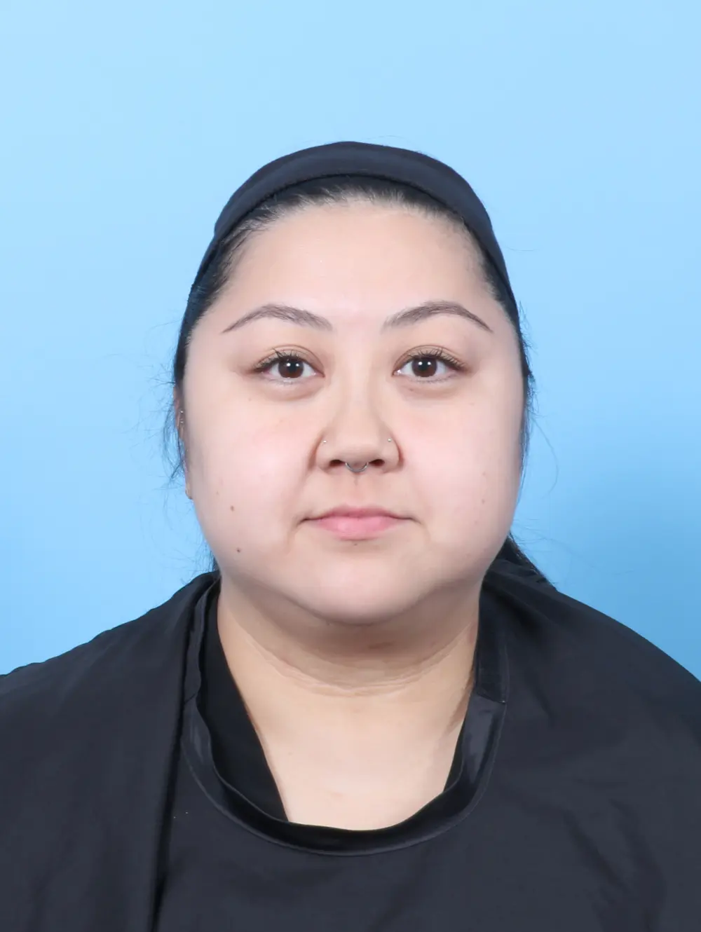 Liposuction Patient Photo - Case 58155 - after view-2