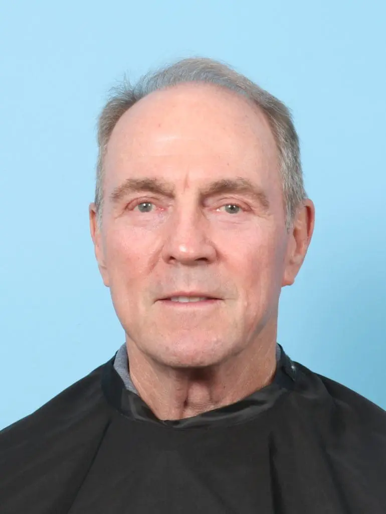 Eyelid Surgery - Case 59076 - After