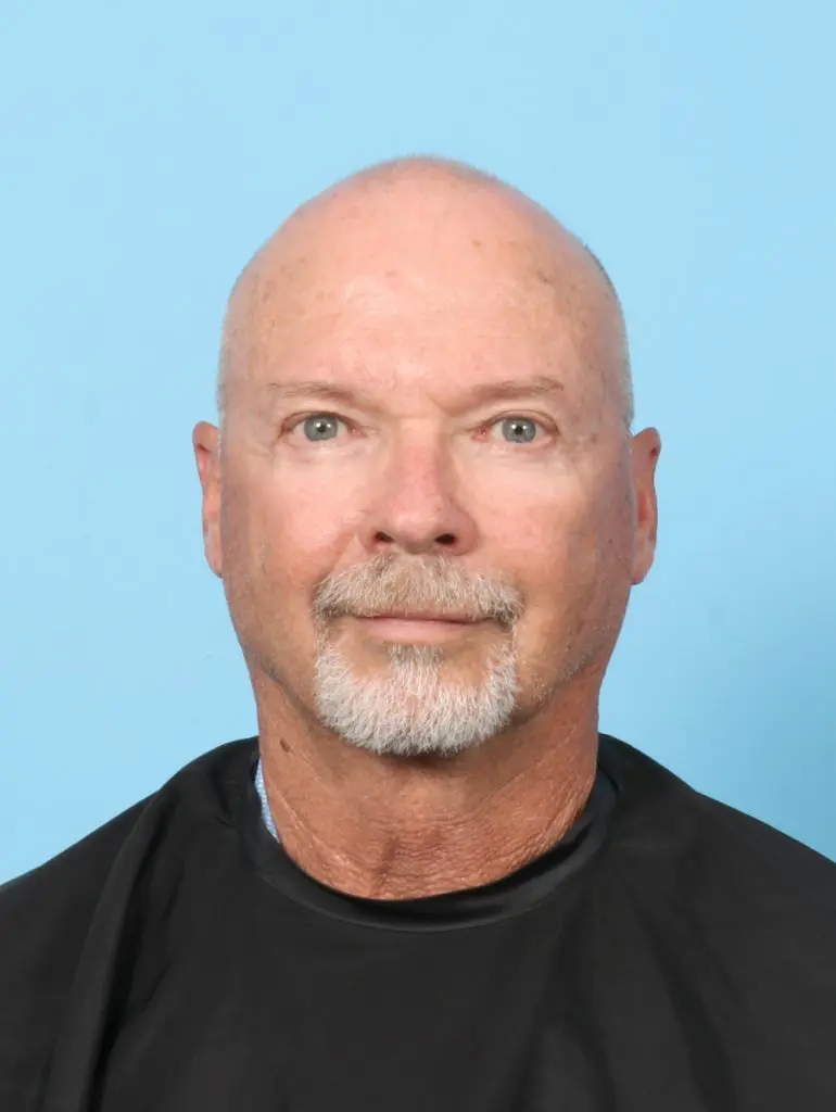 Eyelid Surgery - Case 59160 - After