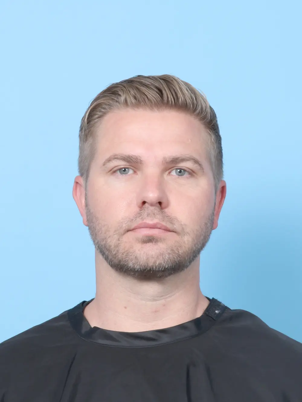 Anterior Neck Lift Patient Photo - Case 59207 - after view-3