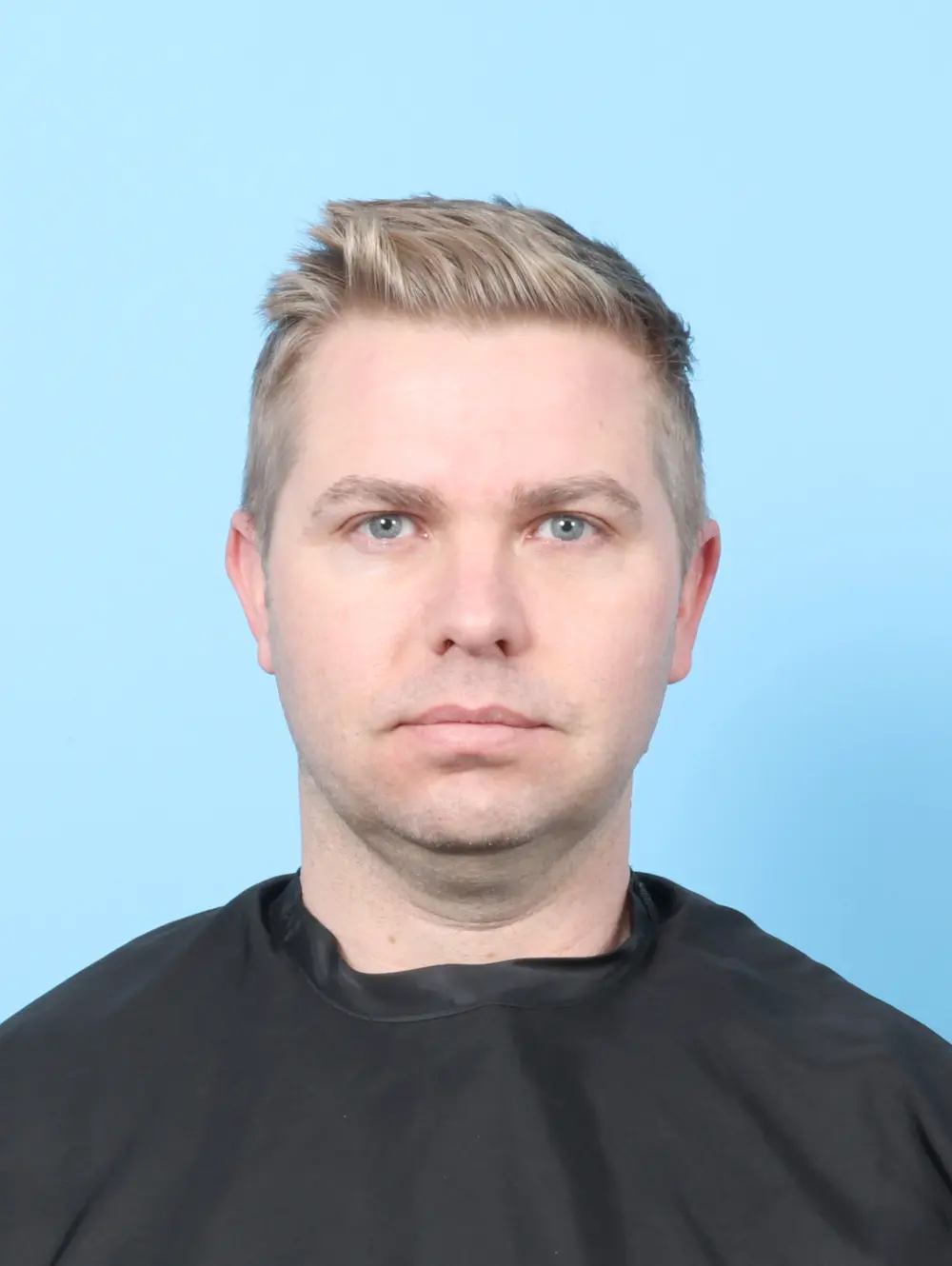 Anterior Neck Lift Patient Photo - Case 59207 - before view-3