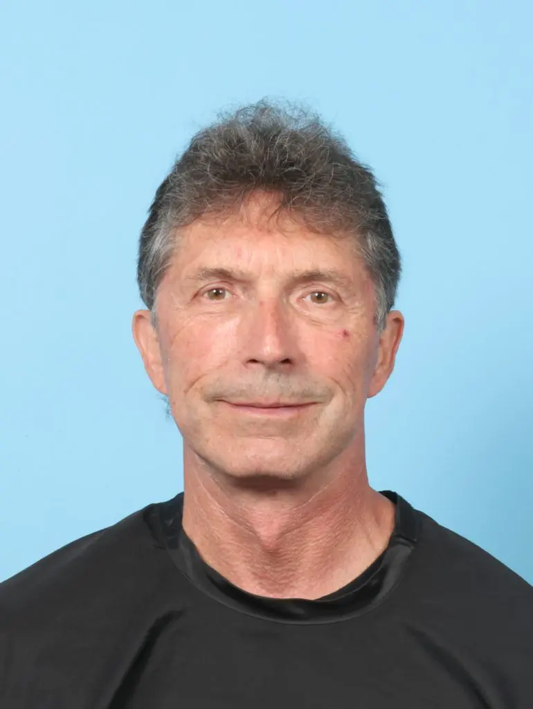 Eyelid Surgery - Case 59254 - After