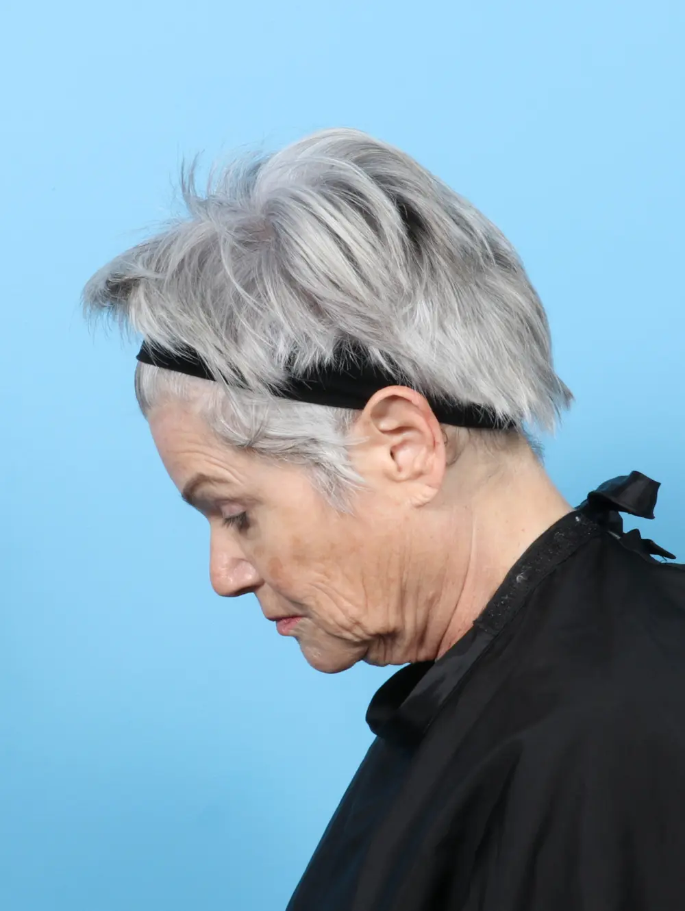 Facelift / Neck Lift Patient Photo - Case 59405 - before view-3