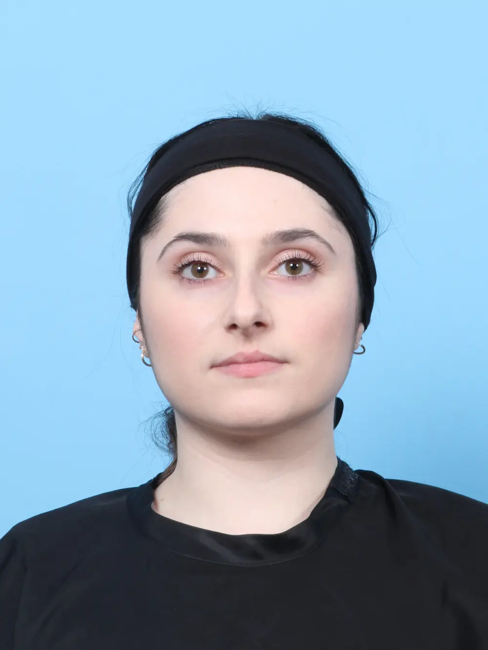 Rhinoplasty Patient Photo - Case 60555 - before view-2