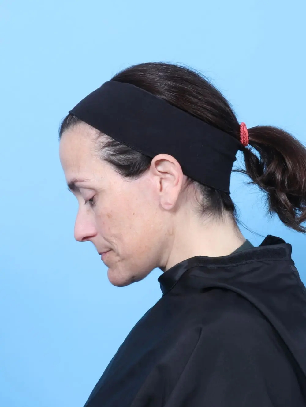 Eyelid Surgery Patient Photo - Case 60778 - after view-3